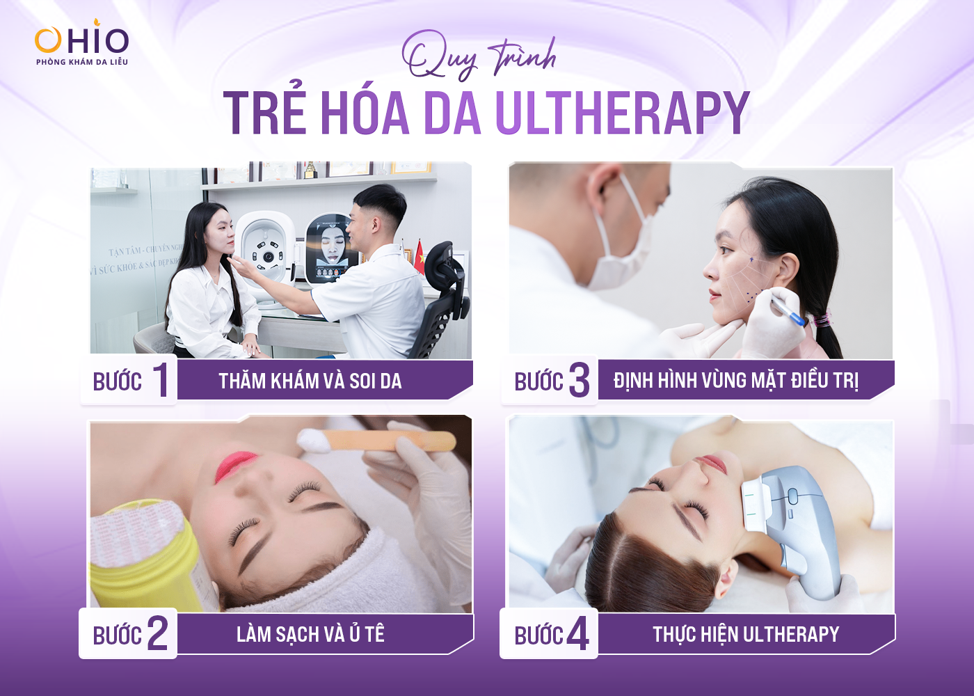 Công Nghệ Trẻ Hóa Da Ultherapy - Giải Pháp Nâng Cơ Không Phẫu Thuật - Phòng khám da liễu OHIO quy trình trẻ hóa bằng công nghệ Ultherapy