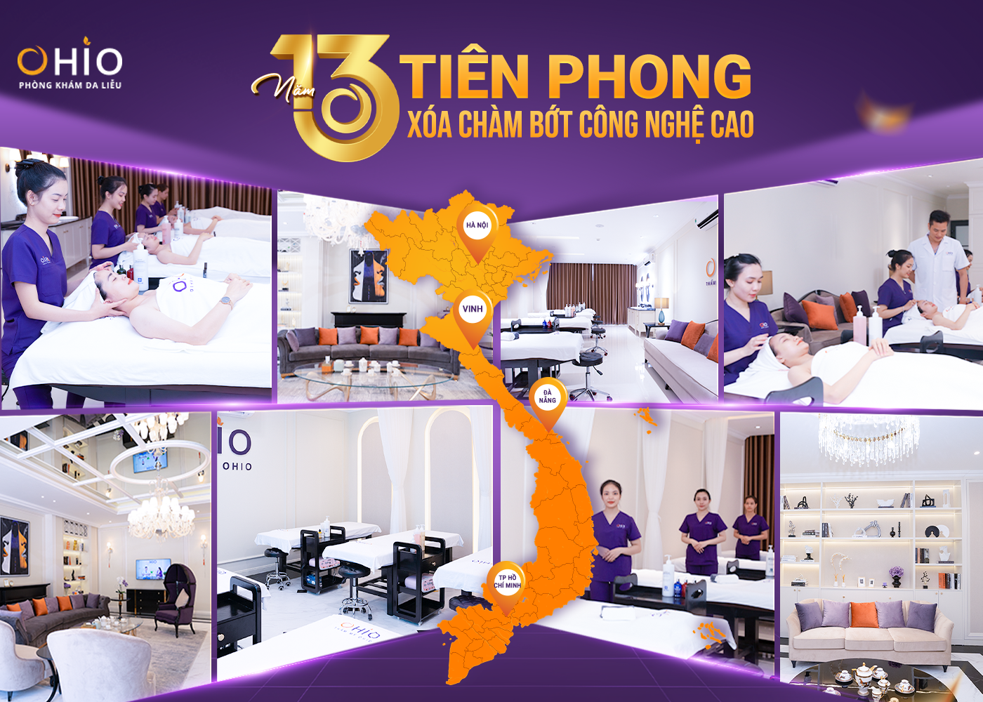 Xóa chàm bớt tại phòng khám da liễu OHIO - Địa chỉ xóa chàm tốt hiện nay - Phòng khám da liễu OHIO xoá chàm bớt