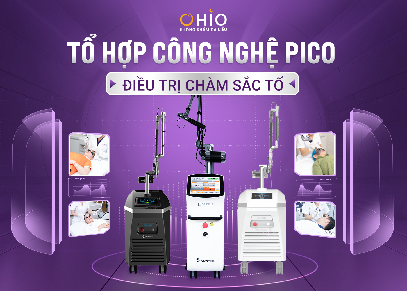 XÓA CHÀM BỚT VÙNG MẶT BẰNG PHƯƠNG PHÁP NÀO HIỆU QUẢ? - Phòng khám da liễu OHIO XÓA CHÀM BỚT VÙNG MẶT BẰNG PHƯƠNG PHÁP NÀO HIỆU QUẢ?