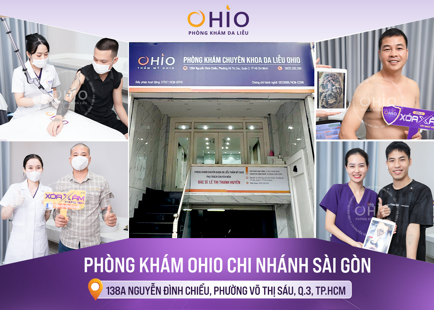 địa chỉ xóa xăm uy tín