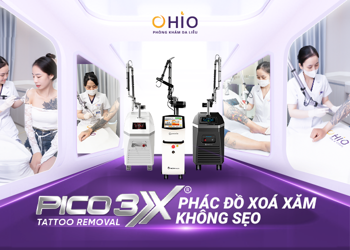 Giá xóa hình xăm tại Phòng khám da liễu OHIO? Các yếu tố ảnh hưởng đến giá