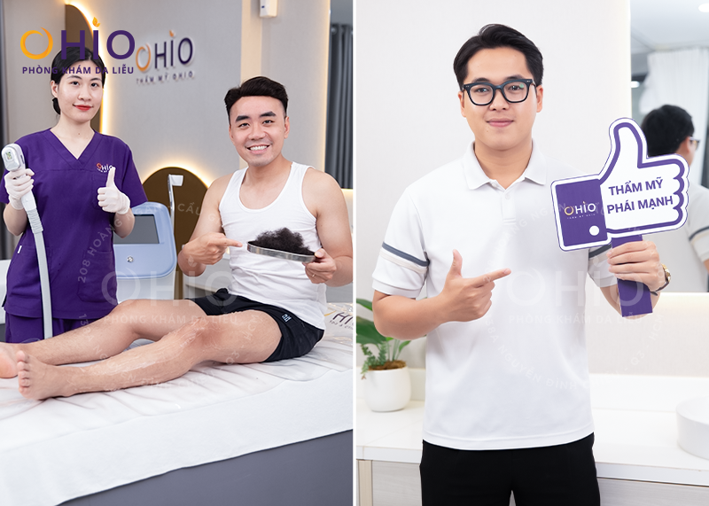 Triệt lông cho Nam TP.HCM tại Thẩm mỹ OHIO được cấp phép của Sở Y tế - Phòng khám da liễu OHIO Khách hàng triệt lông tại thẩm mỹ OHIO