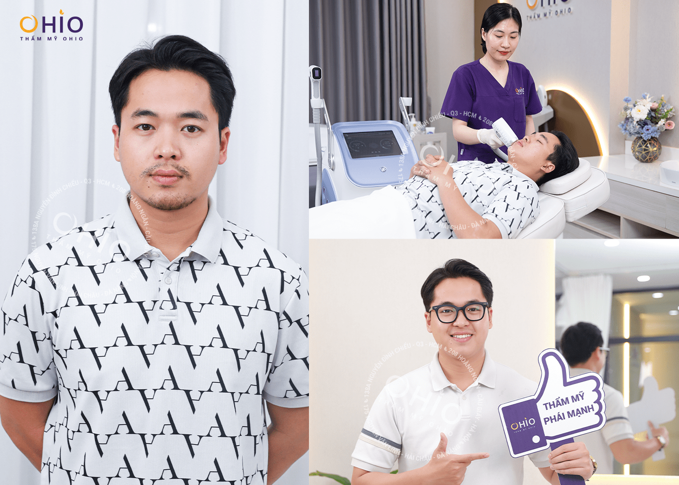 TRIỆT RÂU QUAI NÓN, CỨNG RẬM GIÁ BAO NHIÊU ? - Phòng khám da liễu OHIO TRIỆT RÂU QUAI NÓN, CỨNG RẬM GIÁ BAO NHIÊU ?