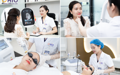 Tạm biệt gương mặt đỏ rực vì giãn mao mạch – Chị Hoài Thơm và hành trình hồi phục da tại OHIO - Phòng khám da liễu OHIO giãn mao mạch