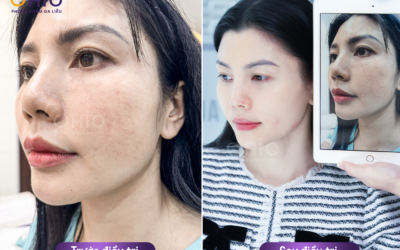 Phòng khám da liễu OHIO có tốt không? Chia sẻ thực tế từ khách hàng sử dụng dịch vụ - Phòng khám da liễu OHIO Phòng khám da liễu OHIO có tốt không? Chia sẻ thực tế từ khách hàng sử dụng dịch vụ