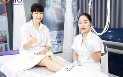 Trị giãn mao mạch chân phòng ngừa giãn tĩnh mạch (Chị Ái Liên - 54 tuổi) - Phòng khám da liễu OHIO Giãn mao mạch chân
