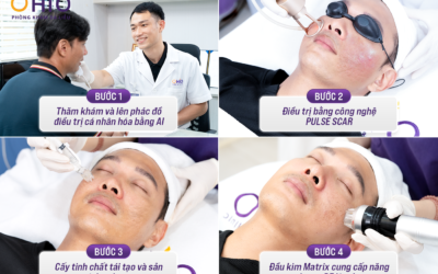 Trị Sẹo Rỗ Hiệu Quả Tại Đà Nẵng: Phòng Khám Da Liễu OHIO - Địa Chỉ Uy Tín Được Sở Y Tế Cấp Phép - Phòng khám da liễu OHIO Trị Sẹo Rỗ Hiệu Quả Tại Đà Nẵng: Phòng Khám Da Liễu OHIO - Địa Chỉ Uy Tín Được Sở Y Tế Cấp Phép