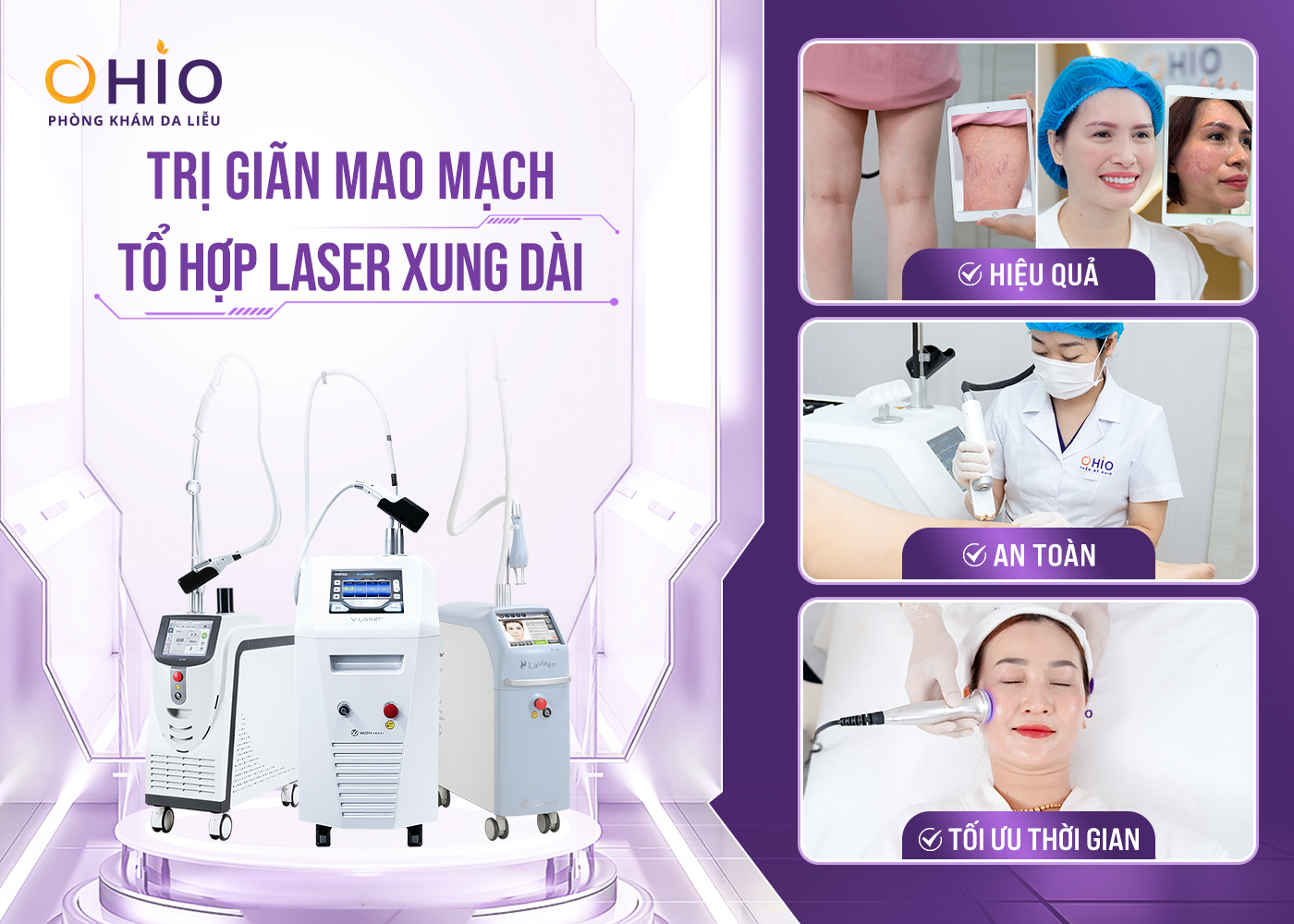Trị giãn mao mạch ở đâu uy tín? - Phòng khám da liễu OHIO Trị giãn mao mạch ở đâu uy tín?