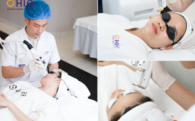 Giãn mao mạch mặt, nguyên nhân và cách điều trị