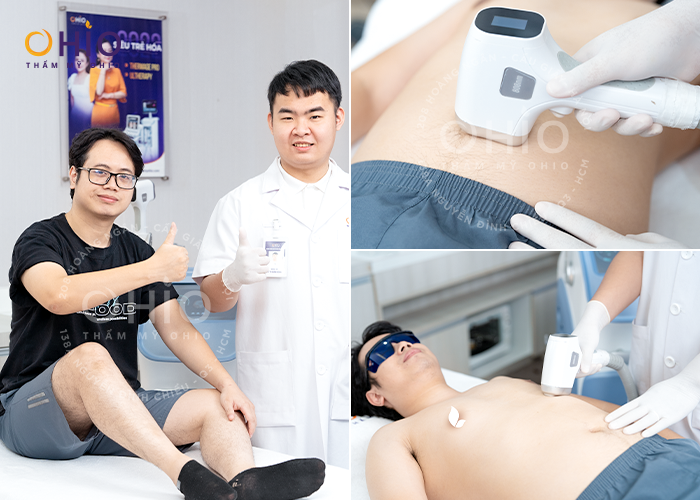 Công nghệ triệt lông Laser Diode M3 – Triệt lông chuyên sâu dành riêng cho nam giới
