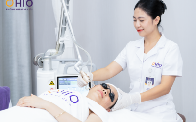 TRỊ SẸO RỖ KHÔNG CẦN PHẪU THUẬT BẰNG CÔNG NGHỆ PULSE SCAR - Phòng khám da liễu OHIO sẹo rỗ