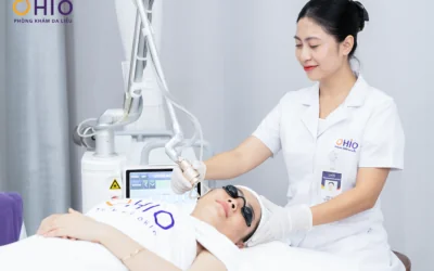 TRỊ SẸO RỖ KHÔNG CẦN PHẪU THUẬT BẰNG CÔNG NGHỆ PULSE SCAR - Phòng khám da liễu OHIO sẹo rỗ