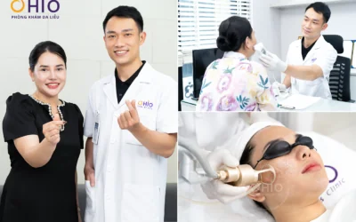 Lo Sẹo Rỗ Tái Phát? Tổ Hợp Công Nghệ Pulse Scar Giúp Làn Da Mịn Màng Lâu Dài - Phòng khám da liễu OHIO Lo Sẹo Rỗ Tái Phát? Tổ Hợp Công Nghệ Pulse Scar Giúp Làn Da Mịn Màng Lâu Dài