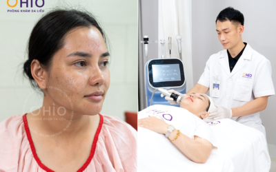 Bác Sĩ Da liễu Nguyễn Thế Anh: “Điều trị sẹo rỗ phải có phác đồ phù hợp và cần dựa trên cơ sở khoa học”