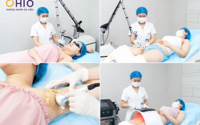 Khi làn da sau sinh bật “tín hiệu cầu cứu” – Hành trình tìm lại sự tự tin của chị Thu Hằng - Phòng khám da liễu OHIO Khi làn da sau sinh bật “tín hiệu cầu cứu” – Hành trình tìm lại sự tự tin của chị Thu Hằng
