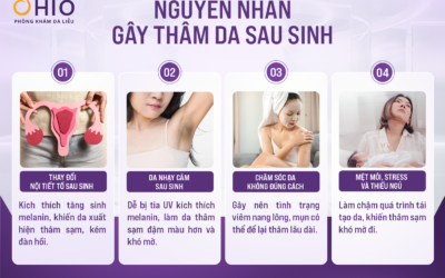 Hiểu đúng về thâm sau sinh để tìm cách chăm sóc hiệu quả - Phòng khám da liễu OHIO thâm sạm