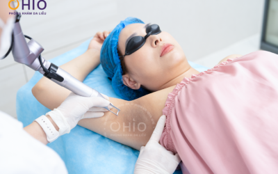 Điều trị thâm da: Giải pháp y khoa lấy lại làn da sáng mịn và tự tin