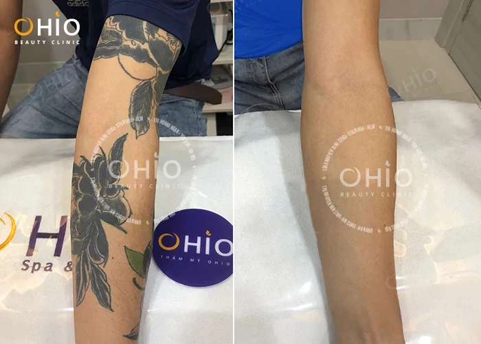 3 TABOOS IN TATTOOING YOU MUST AVOID IF YOU DON’T WANT TO BRING MISFORTUNE INTO YOUR LIFE - Phòng khám da liễu OHIO 3 TABOOS IN TATTOOING YOU MUST AVOID IF YOU DON’T WANT TO BRING MISFORTUNE INTO YOUR LIFE
