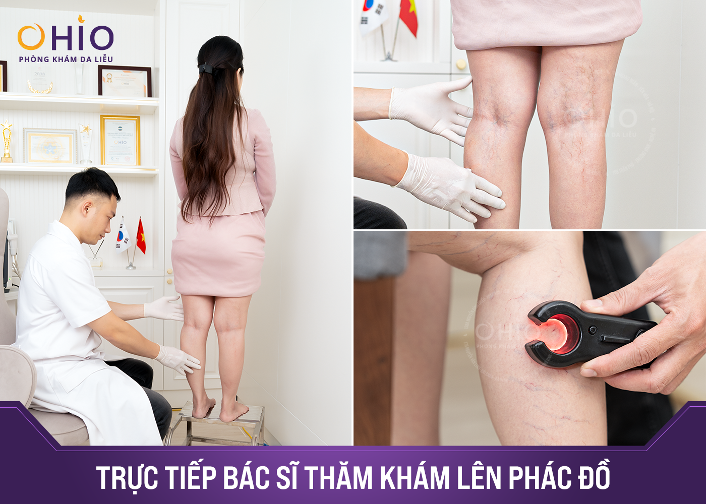 Dược sĩ Thu Hương: Trị giãn mao mạch - Tôi tin chọn OHIO