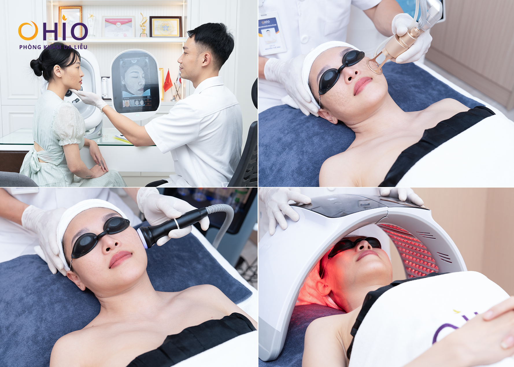 Chị Bạch Tuyết tìm lại nhan sắc và sự tự tin nhờ xóa sạch sẹo rỗ - Phòng khám da liễu OHIO Chị Bạch Tuyết tìm lại nhan sắc và sự tự tin nhờ xóa sạch sẹo rỗ