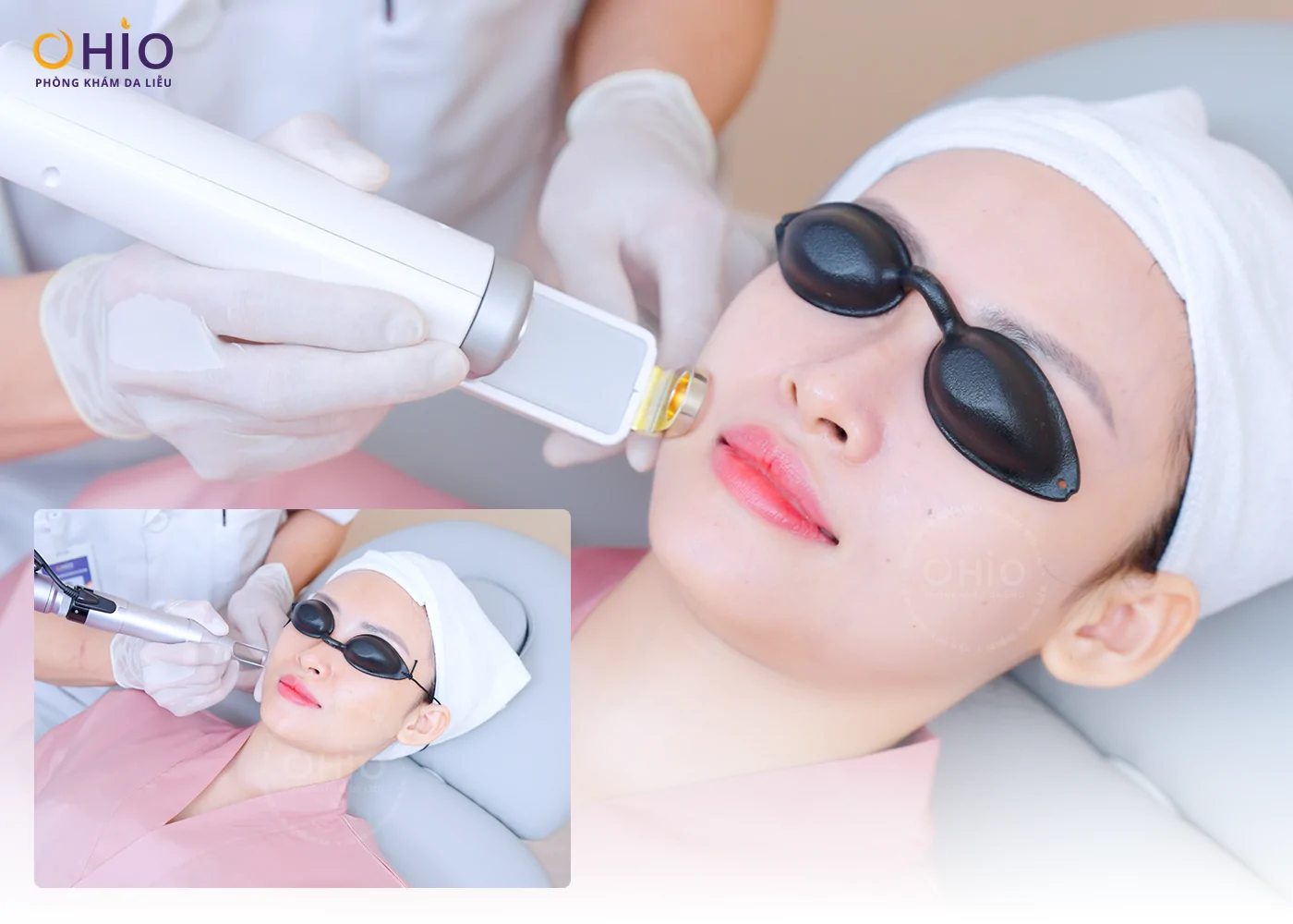 KHÁM PHÁ “SKIN RESET DAY” – NGÀY HỘI TÁI TẠO LÀN DA CHUYÊN SÂU TẠI OHIO - Phòng khám da liễu OHIO KHÁM PHÁ “SKIN RESET DAY” – NGÀY HỘI TÁI TẠO LÀN DA CHUYÊN SÂU TẠI OHIO