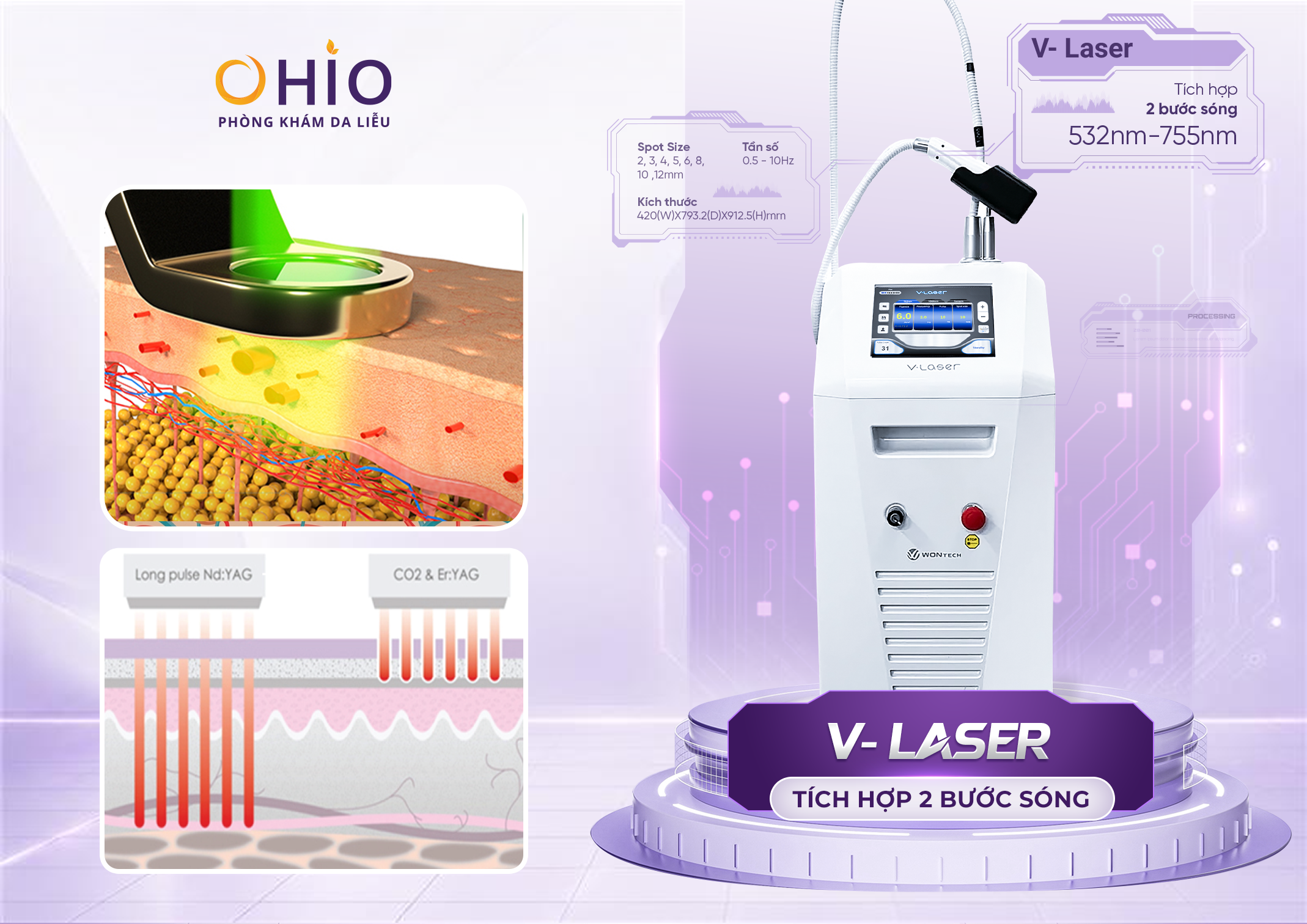Vết bớt rượu vang: Nguyên nhân, dấu hiệu và cách điều trị hiệu quả - Phòng khám da liễu OHIO Vết bớt rượu vang: Nguyên nhân, dấu hiệu và cách điều trị hiệu quả