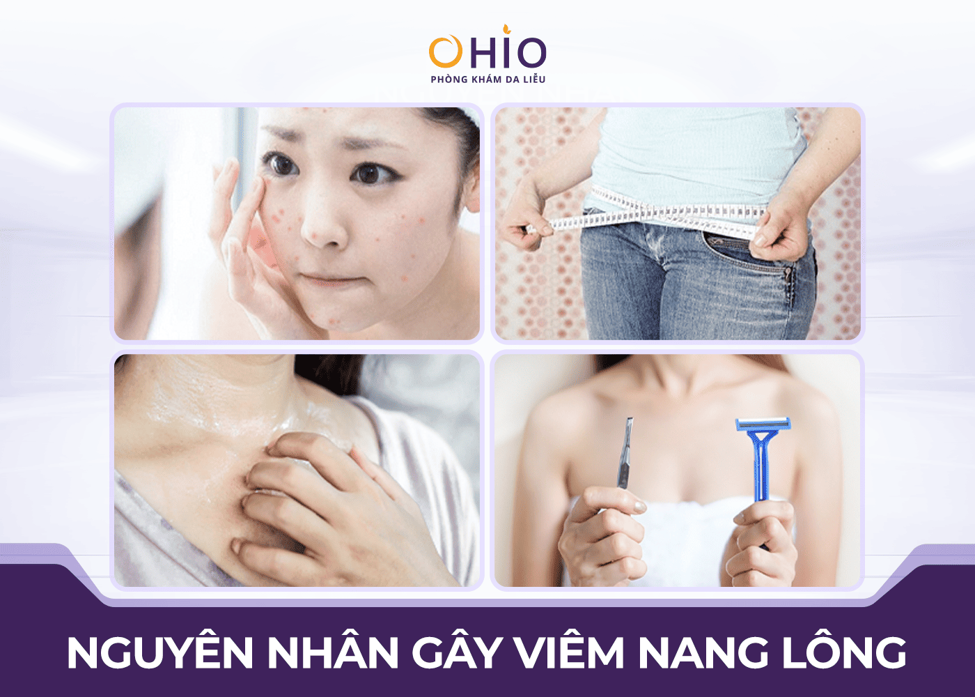 Viêm nang lông: Nhận biết sớm, phòng ngừa và hướng điều trị đúng cách - Phòng khám da liễu OHIO Nguyên nhân gây viêm nang lông