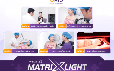 Viêm nang lông có điều trị được không? Góc nhìn từ những khách hàng đã cải thiện tại OHIO