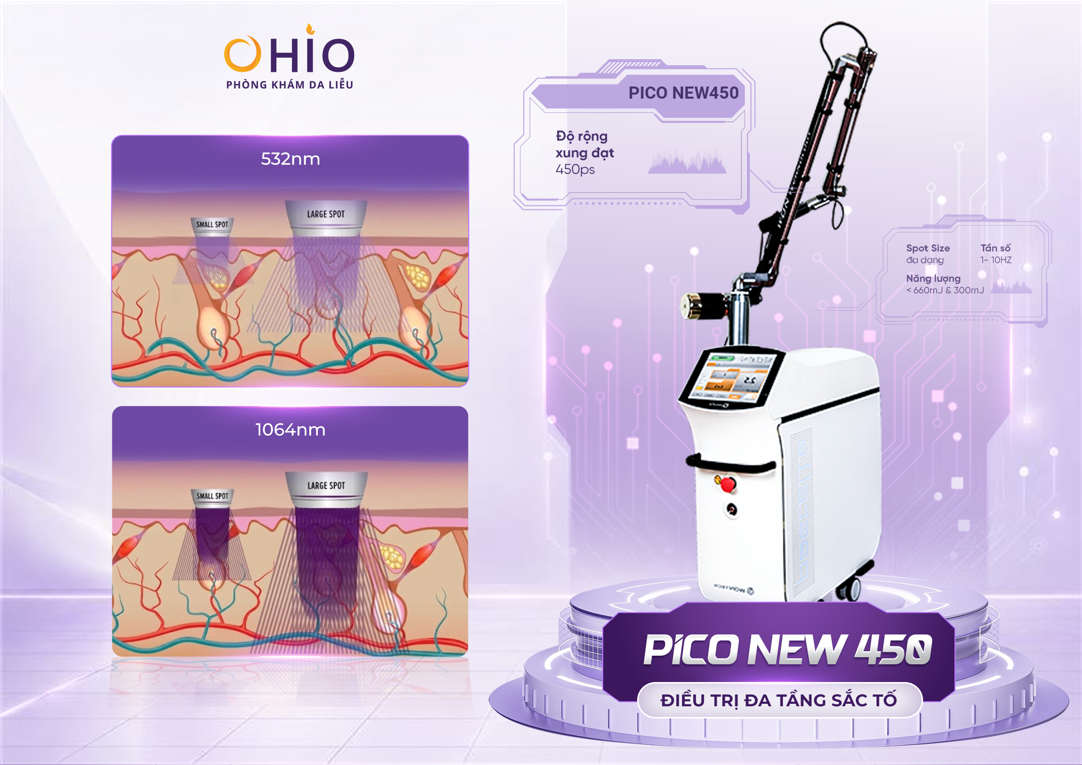 Xóa chàm bớt sắc tố tại OHIO và những điều cần biết