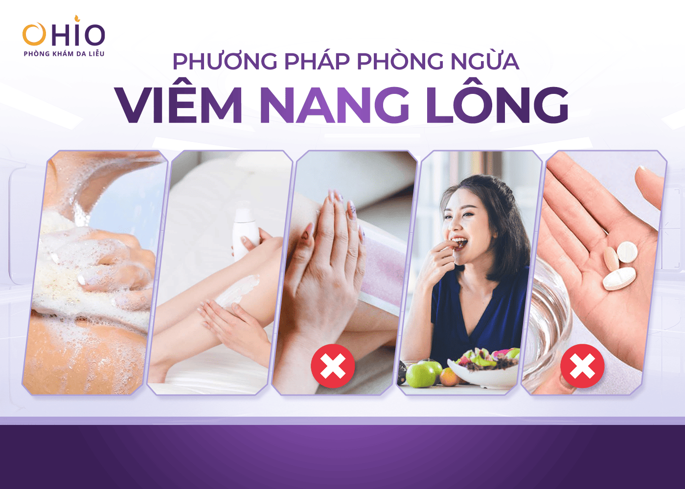 Viêm nang lông: Nhận biết sớm, phòng ngừa và hướng điều trị đúng cách - Phòng khám da liễu OHIO Viêm nang lông: Nhận biết sớm, phòng ngừa và hướng điều trị đúng cách