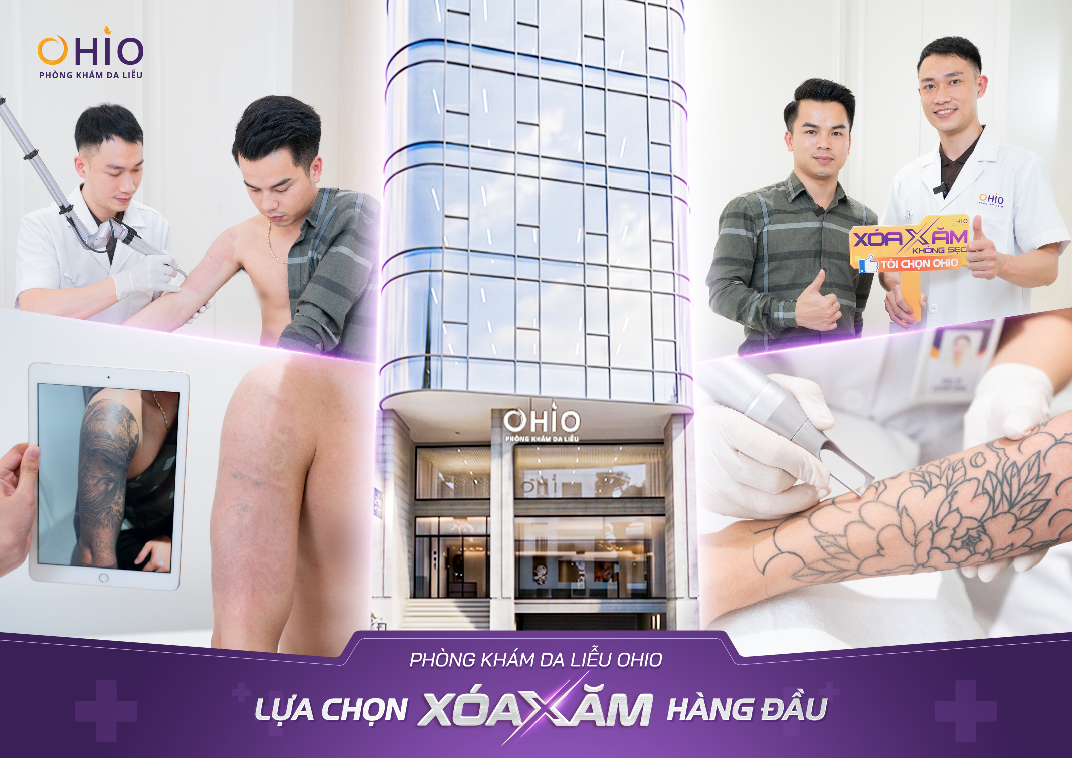 Xoá xăm có đau không? có để lại sẹo không? BS.CK1 chuyên ngành Da liễu giải đáp - Phòng khám da liễu OHIO Xoá xăm có đau không? có để lại sẹo không? BS.CK1 chuyên ngành Da liễu giải đáp