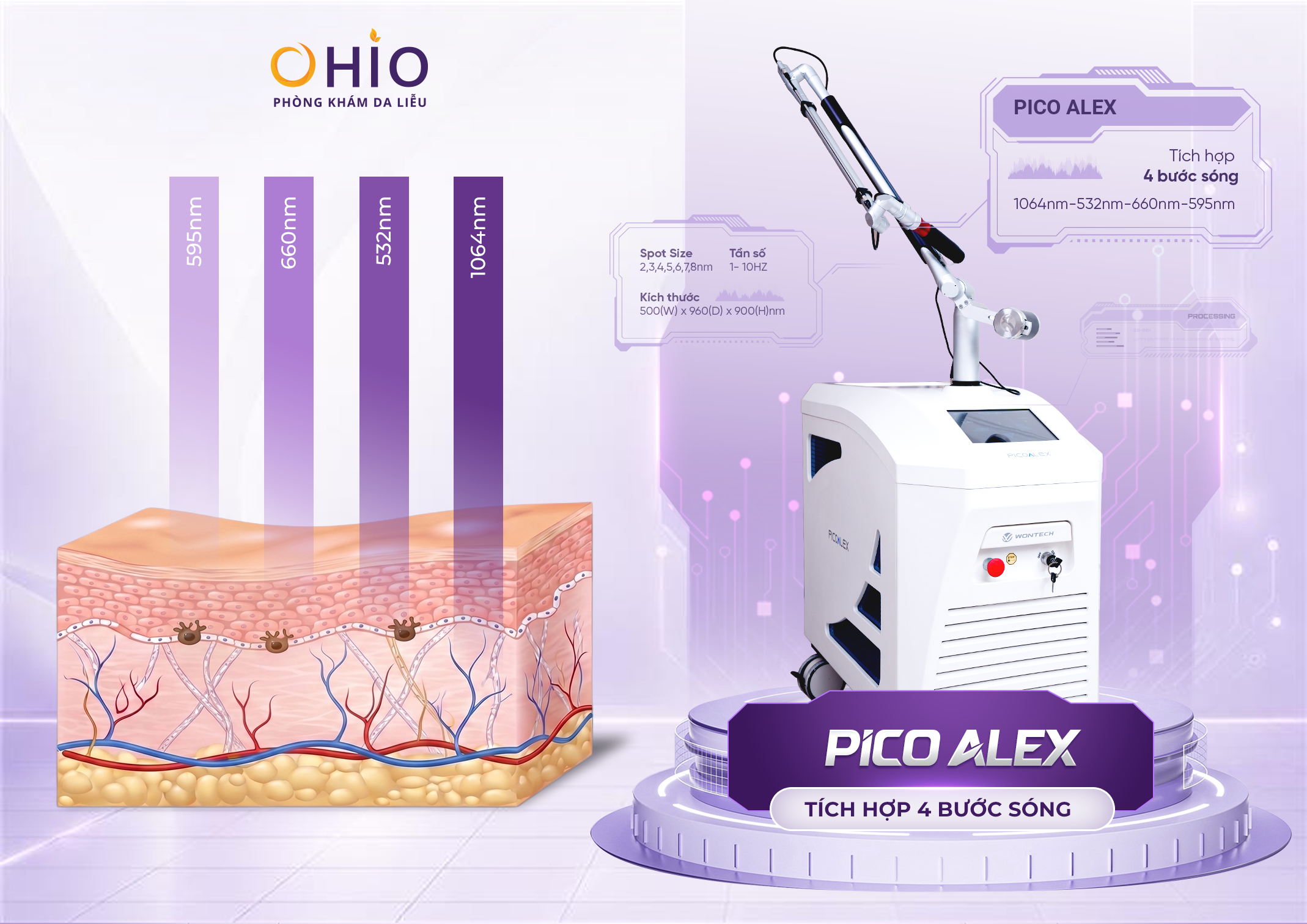 Xóa chàm bớt sắc tố tại OHIO và những điều cần biết