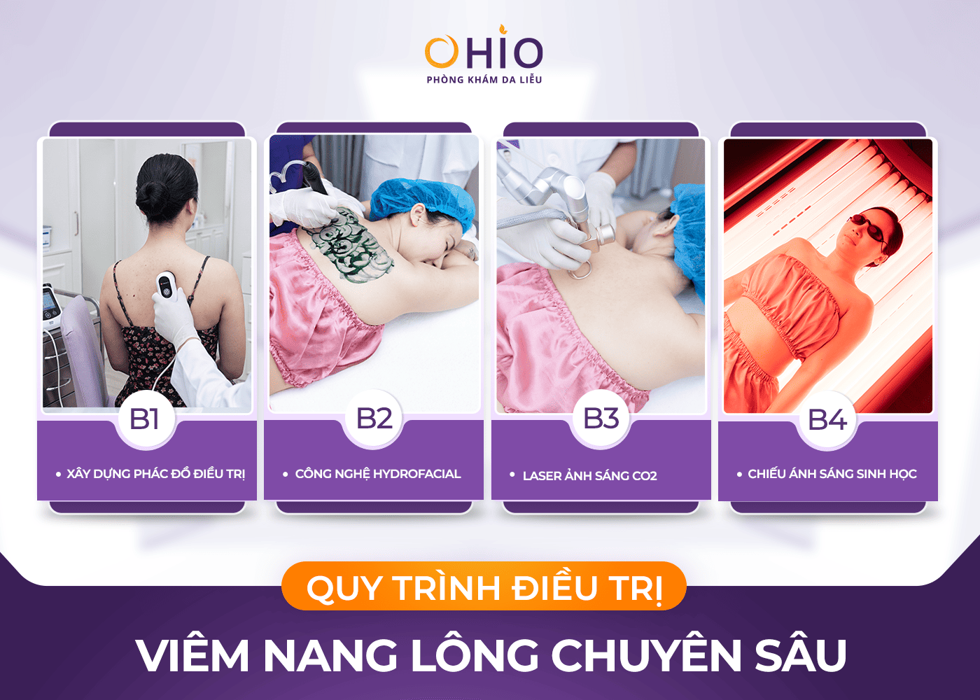 Viêm nang lông: Nhận biết sớm, phòng ngừa và hướng điều trị đúng cách - Phòng khám da liễu OHIO Viêm nang lông: Nhận biết sớm, phòng ngừa và hướng điều trị đúng cách