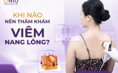 Viêm nang lông sau điều trị cần lưu ý những gì? - Phòng khám da liễu OHIO Viêm nang lông sau điều trị cần lưu ý những gì?