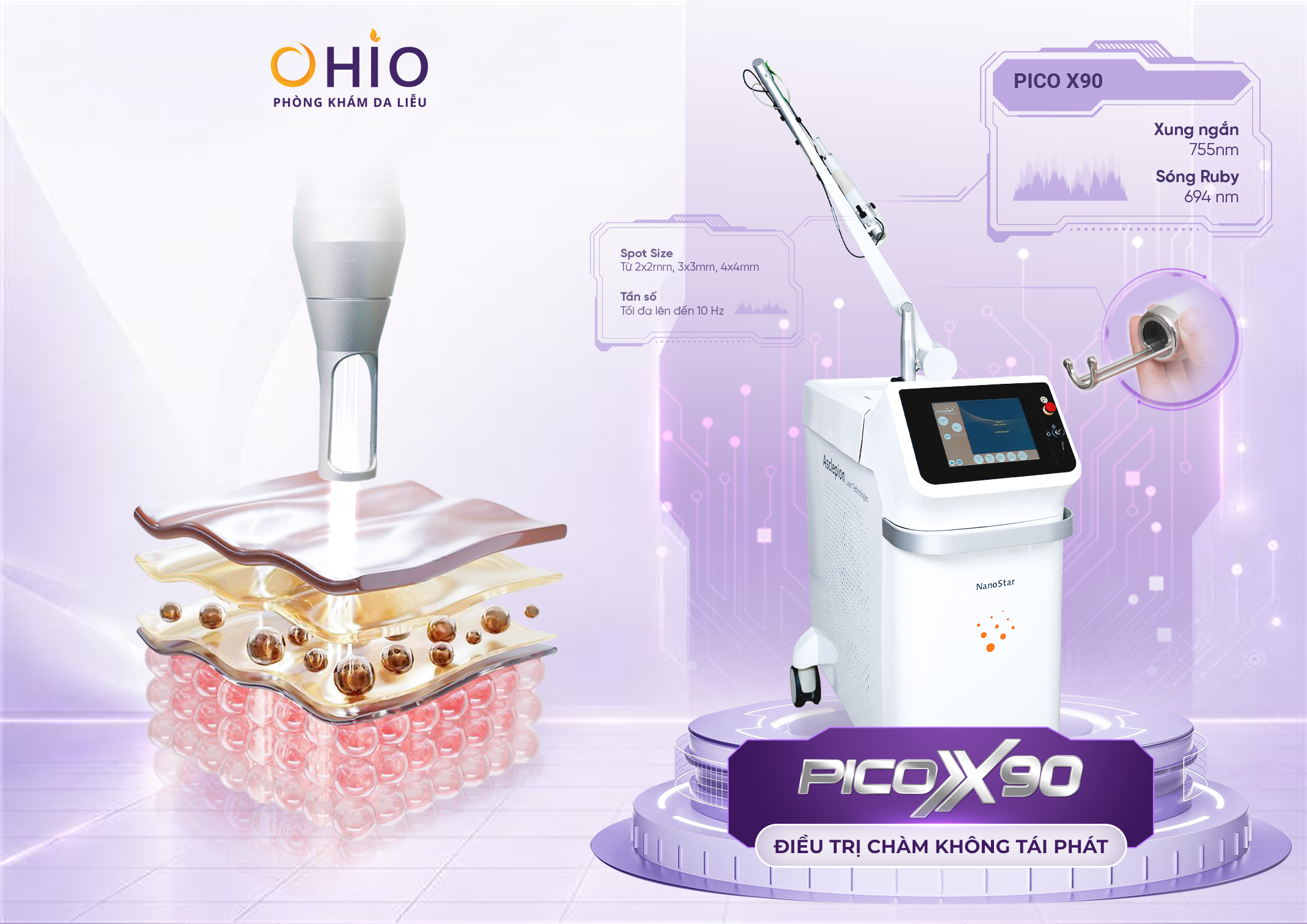 Xóa chàm bớt sắc tố tại OHIO và những điều cần biết