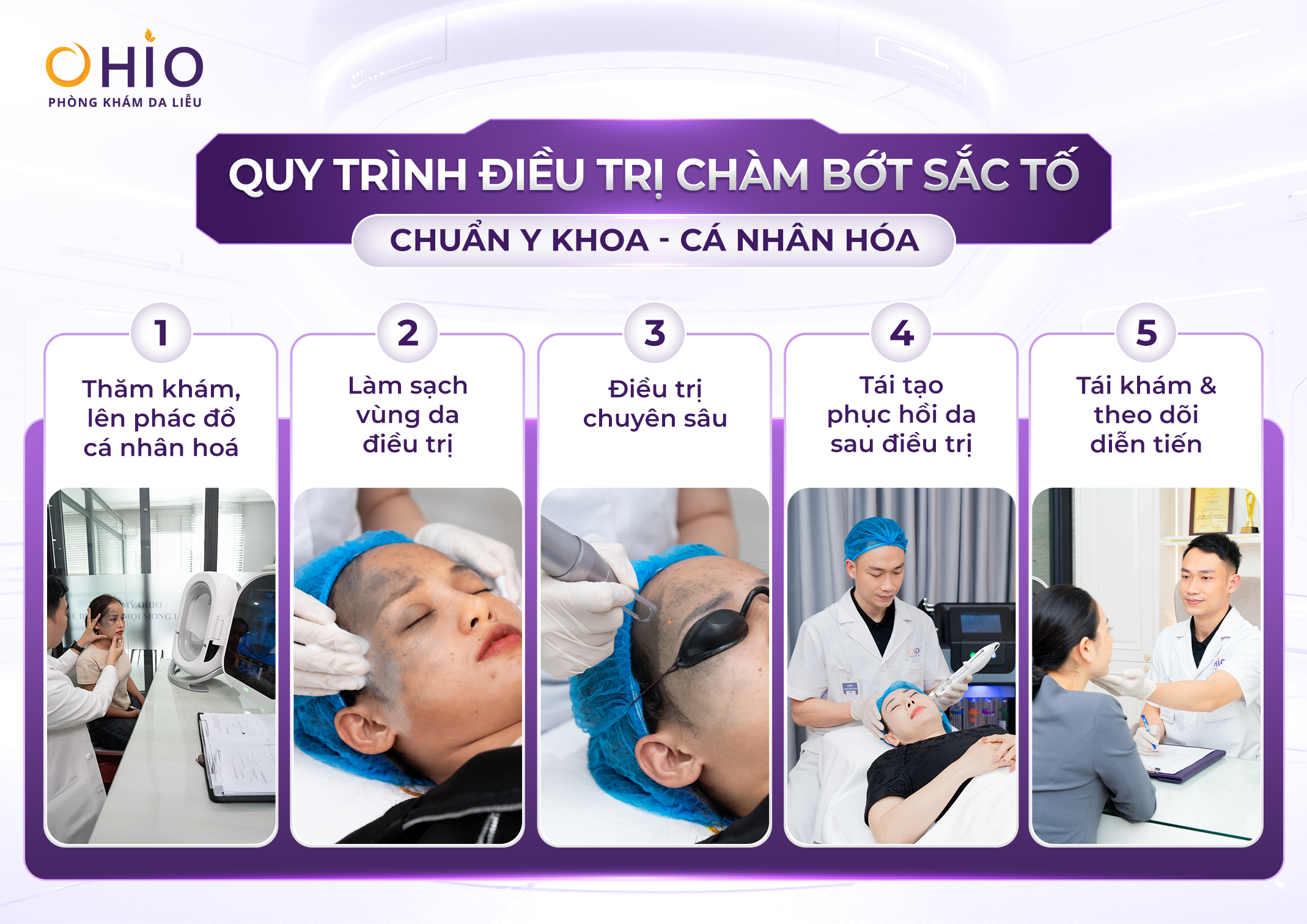 Xóa chàm bớt sắc tố tại OHIO và những điều cần biết