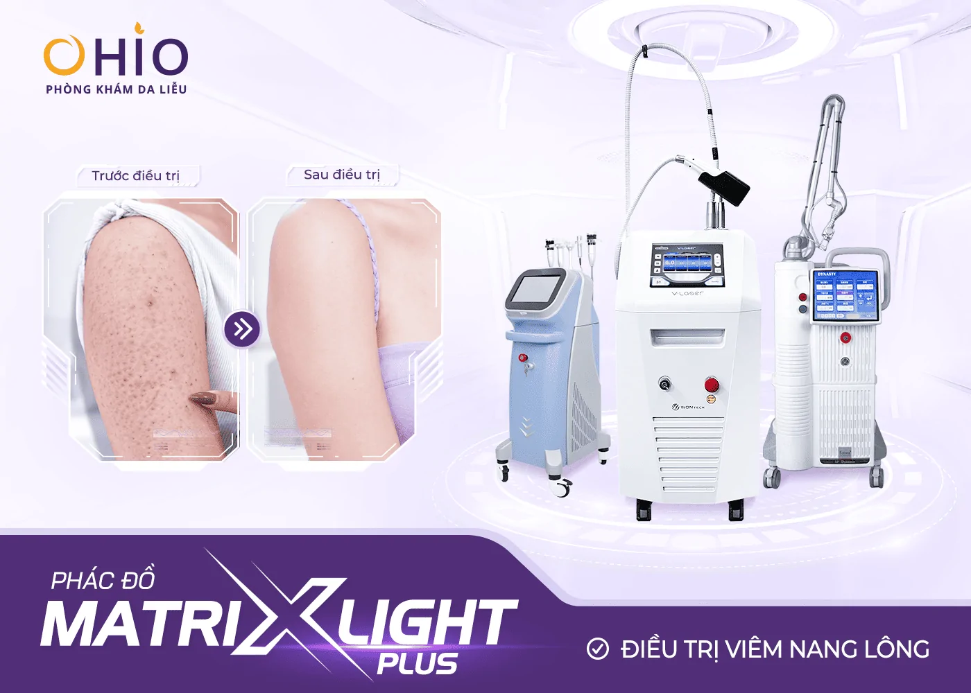 Cảnh báo nguy cơ tiềm tàng khi tự chữa viêm nang lông tại nhà - Phòng khám da liễu OHIO Cảnh báo nguy cơ tiềm tàng khi tự chữa viêm nang lông tại nhà
