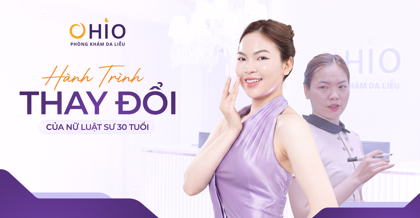 Hành Trình Thay Đổi Của Nữ Luật Sư 30 Tuổi - “Tôi Từng Né Nhìn Thẳng Vào Khách Hàng Chỉ Vì Sẹo Rỗ” - Phòng khám da liễu OHIO Hành Trình Thay Đổi Của Nữ Luật Sư 30 Tuổi - “Tôi Từng Né Nhìn Thẳng Vào Khách Hàng Chỉ Vì Sẹo Rỗ”