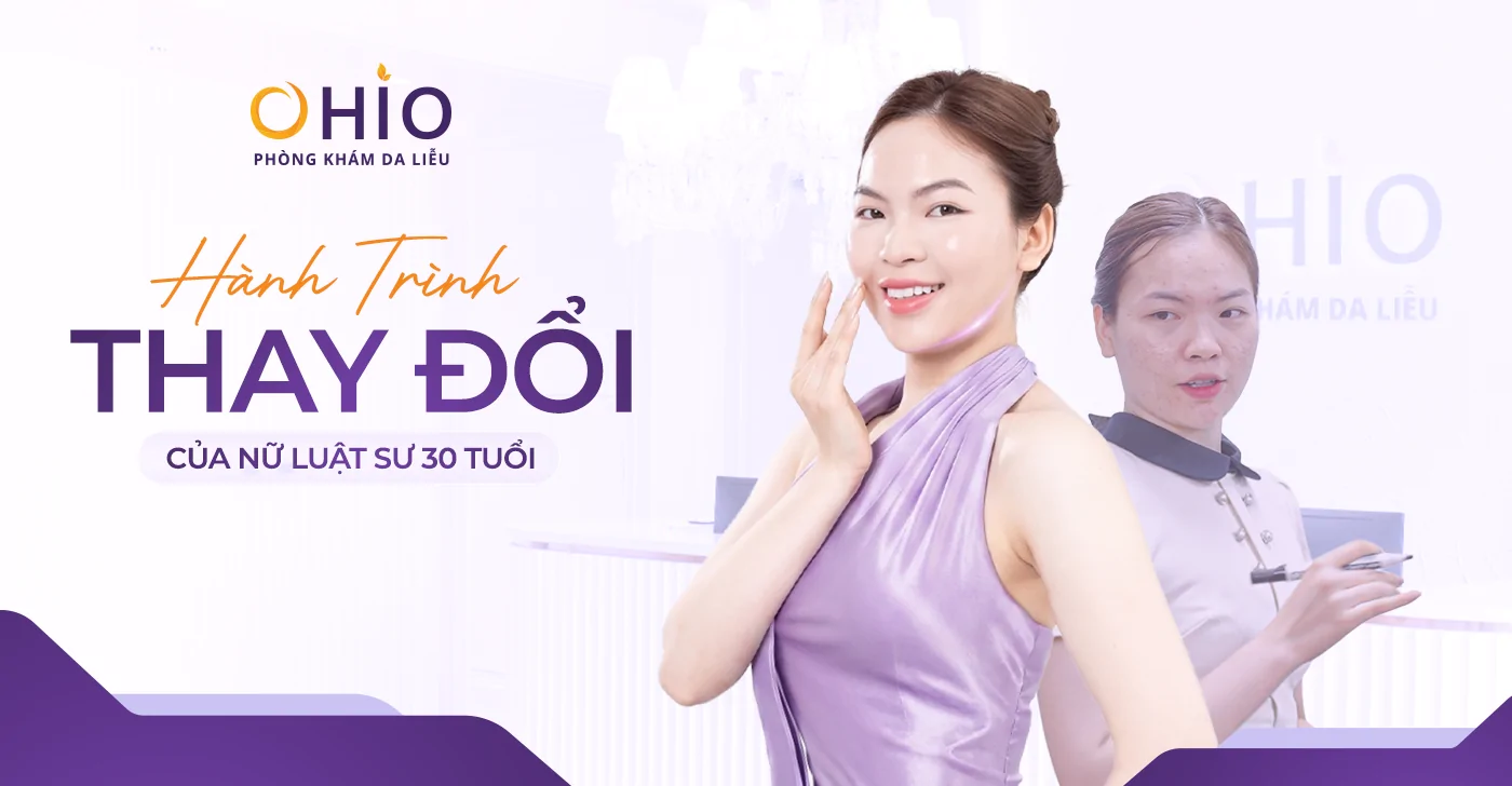 Hành Trình Thay Đổi Của Nữ Luật Sư 30 Tuổi - “Tôi Từng Né Nhìn Thẳng Vào Khách Hàng Chỉ Vì Sẹo Rỗ” - Phòng khám da liễu OHIO Hành Trình Thay Đổi Của Nữ Luật Sư 30 Tuổi - “Tôi Từng Né Nhìn Thẳng Vào Khách Hàng Chỉ Vì Sẹo Rỗ”
