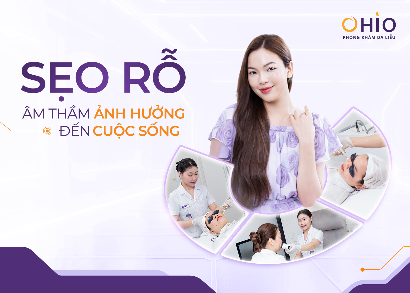 Hành Trình Thay Đổi Của Nữ Luật Sư 30 Tuổi - “Tôi Từng Né Nhìn Thẳng Vào Khách Hàng Chỉ Vì Sẹo Rỗ” - Phòng khám da liễu OHIO Hành Trình Thay Đổi Của Nữ Luật Sư 30 Tuổi - “Tôi Từng Né Nhìn Thẳng Vào Khách Hàng Chỉ Vì Sẹo Rỗ”