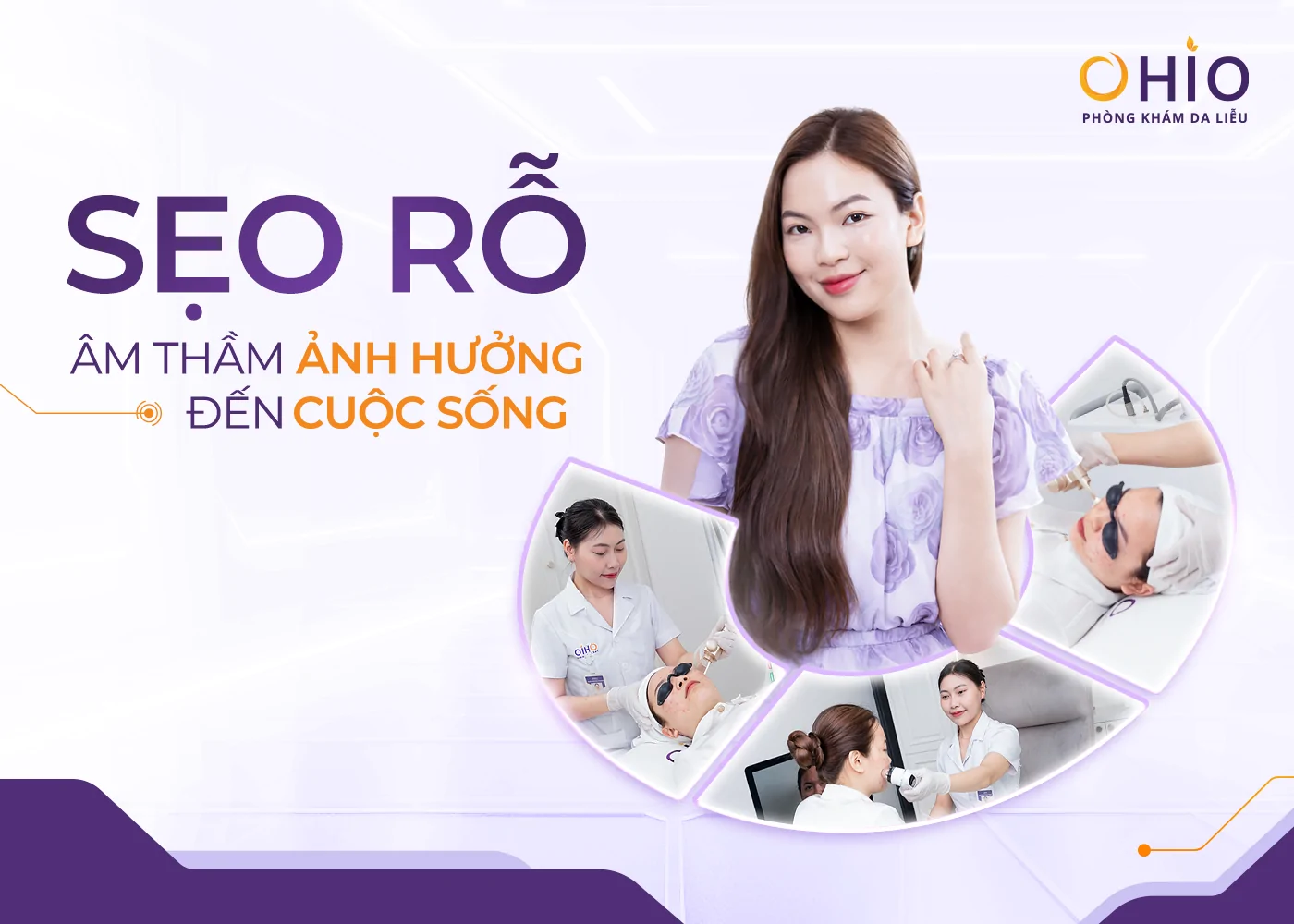 Hành Trình Thay Đổi Của Nữ Luật Sư 30 Tuổi - “Tôi Từng Né Nhìn Thẳng Vào Khách Hàng Chỉ Vì Sẹo Rỗ” - Phòng khám da liễu OHIO Hành Trình Thay Đổi Của Nữ Luật Sư 30 Tuổi - “Tôi Từng Né Nhìn Thẳng Vào Khách Hàng Chỉ Vì Sẹo Rỗ”