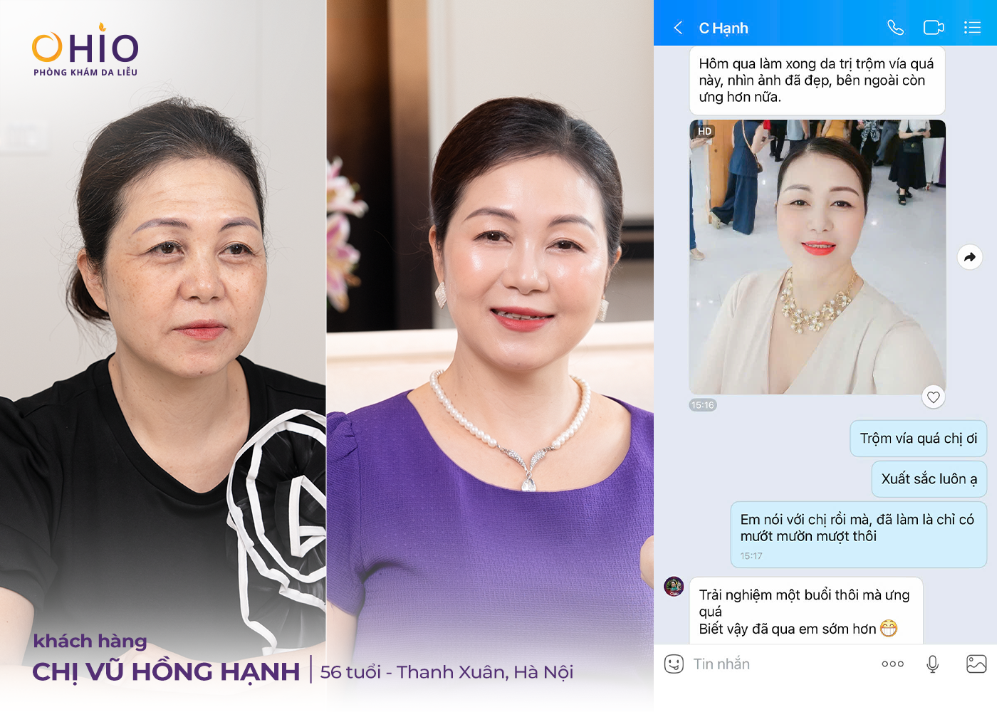 U60 vẫn trẻ đẹp tự tin, hành trình trẻ hóa da của chị Vũ Hồng Hạnh