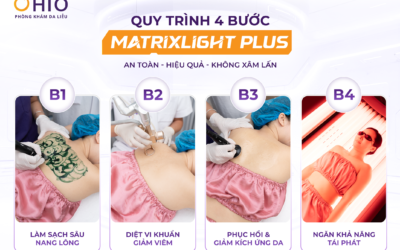 Trị viêm nang lông: Câu chuyện thay đổi Của doanh nhân Thảo Vy