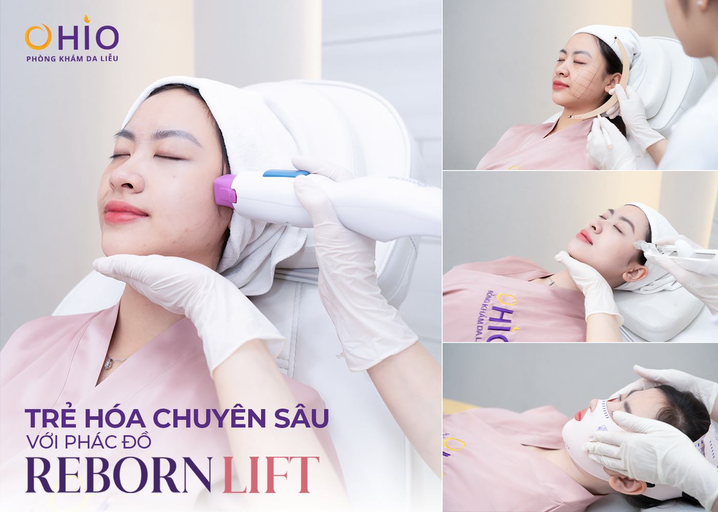 Trẻ hóa tuổi 40: Chị Hải Trang chọn Reborn Lift để gìn giữ vẻ đẹp tự nhiên