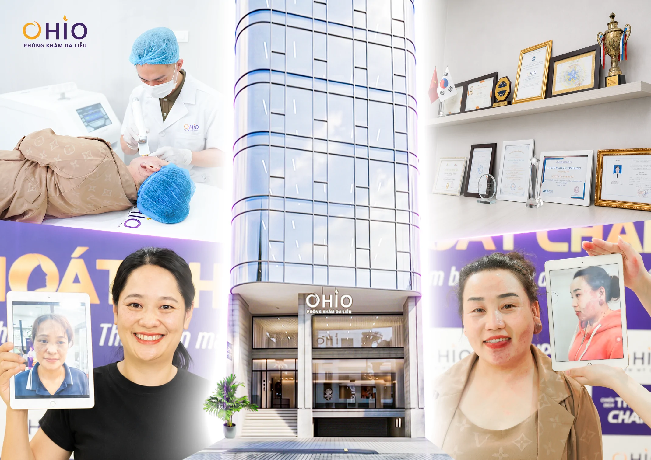 Vì sao OHIO được nhiều khách hàng lựa chọn trong điều trị chàm bớt? - Phòng khám da liễu OHIO Vì sao OHIO được nhiều khách hàng lựa chọn trong điều trị chàm bớt?