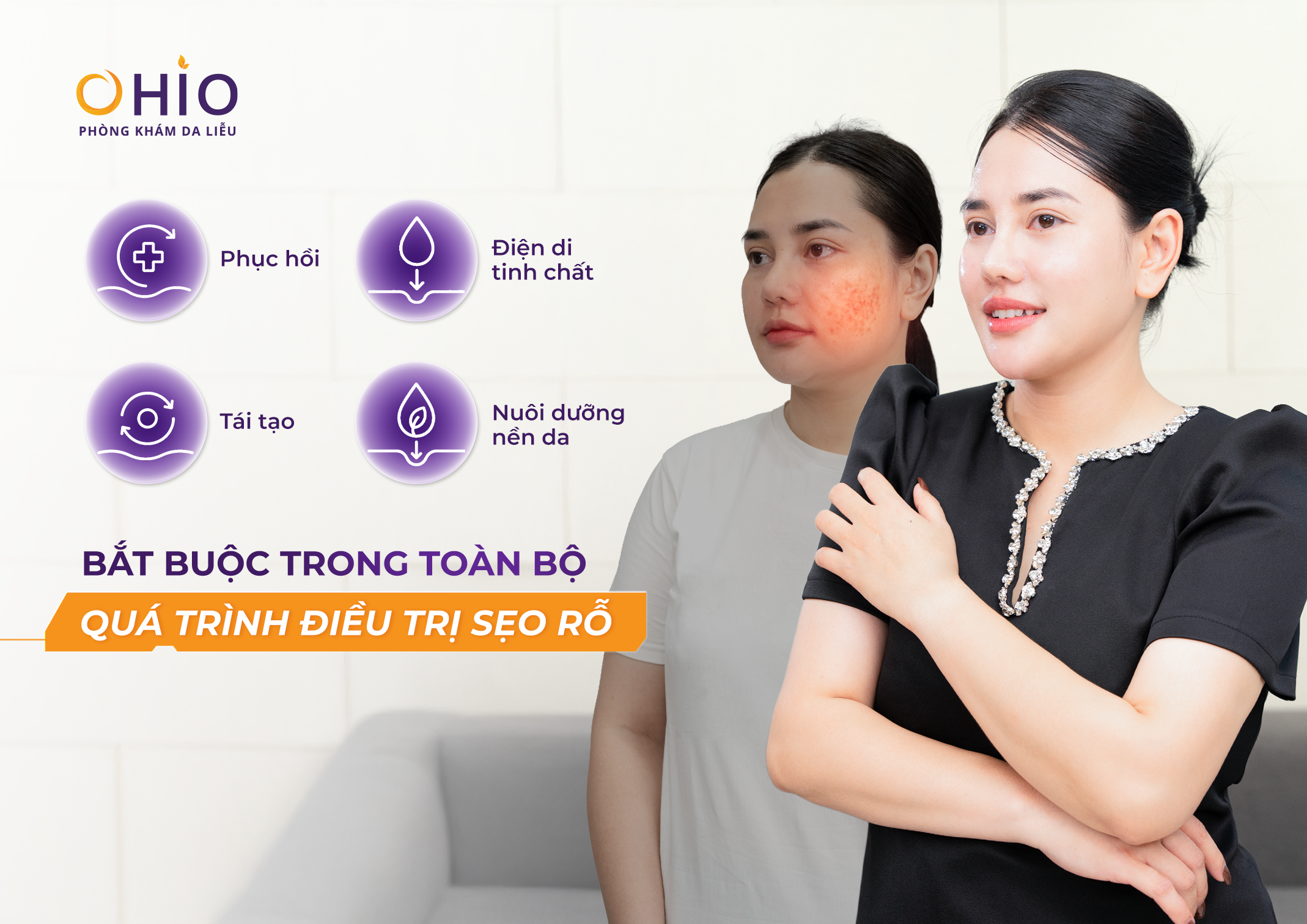 Bác Sĩ Da Liễu Nói Gì Về Xu Hướng Điều Trị Sẹo Rỗ 2026?