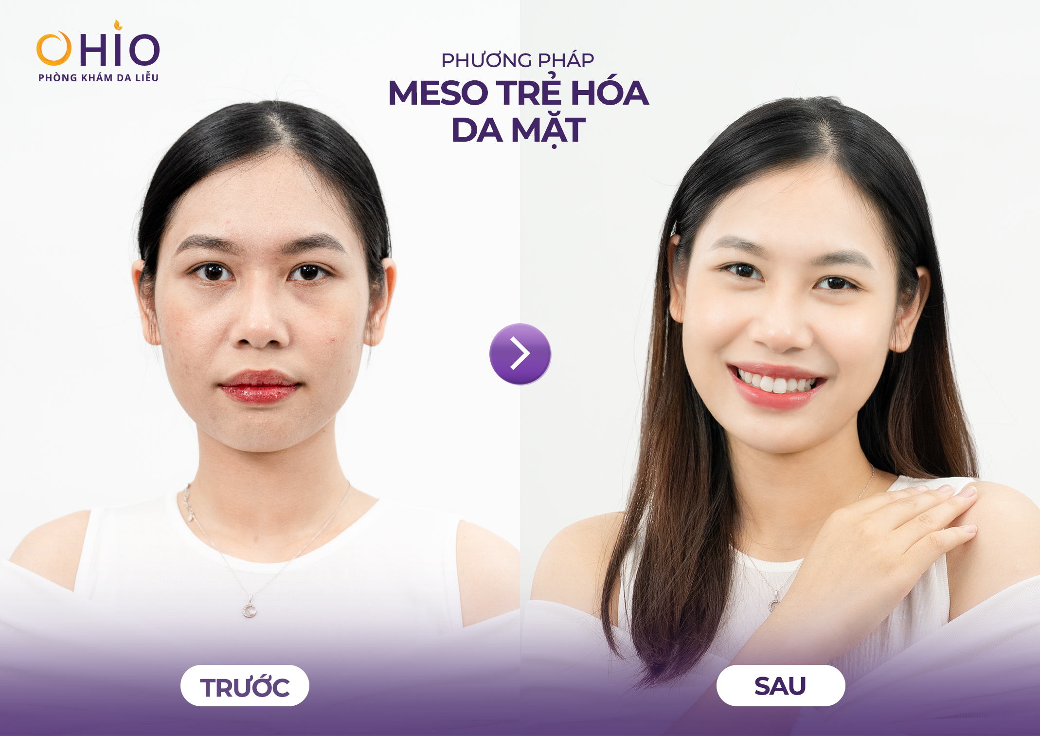 Thẩm mỹ nội khoa là gì? Giải đáp từ BS CKI Đoàn Thị Hồng Nhung