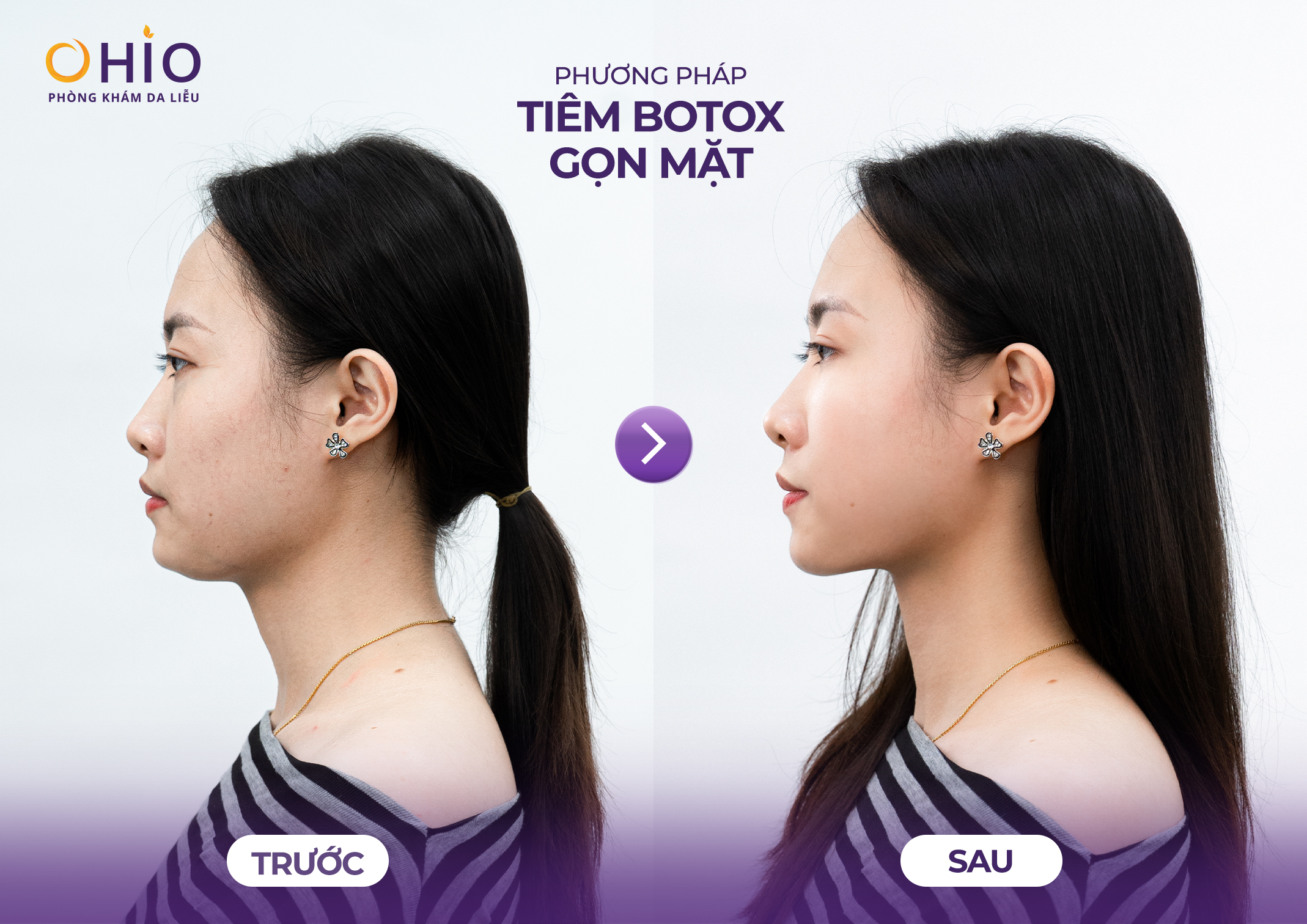 Thẩm mỹ nội khoa là gì? Giải đáp từ BS CKI Đoàn Thị Hồng Nhung