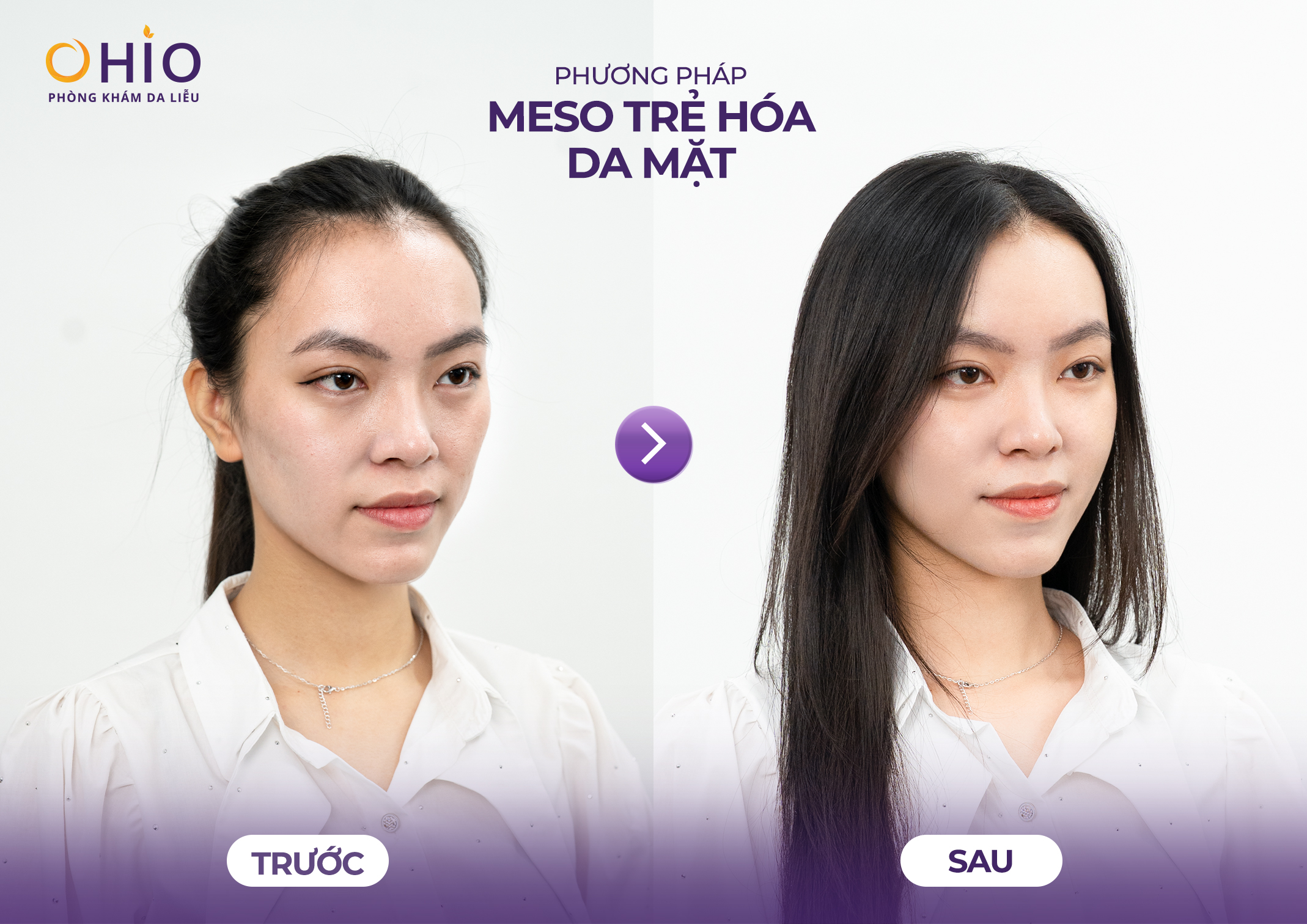Thẩm mỹ nội khoa là gì? Giải đáp từ BS CKI Đoàn Thị Hồng Nhung