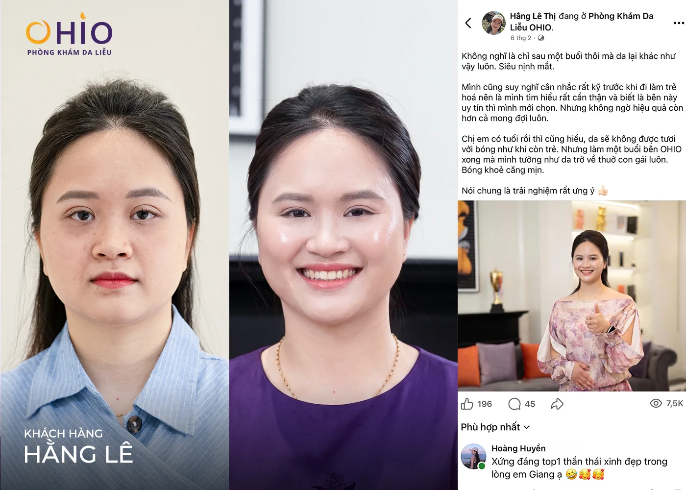 Trẻ hóa cho phụ nữ trung niên: Bận rộn không có nghĩa là bỏ quên bản thân - Phòng khám da liễu OHIO Trẻ hóa cho phụ nữ trung niên: Bận rộn không có nghĩa là bỏ quên bản thân